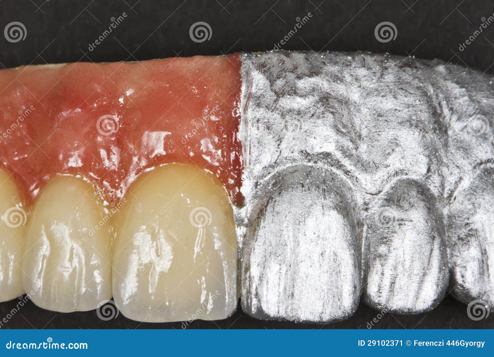 Artificial teeth stock image. Image of front, realistic 29102371