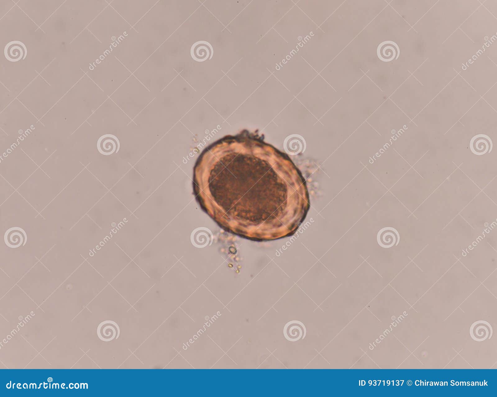 Ascaris Lumbricoides Egg in Stool Exam. Stock Image Image of