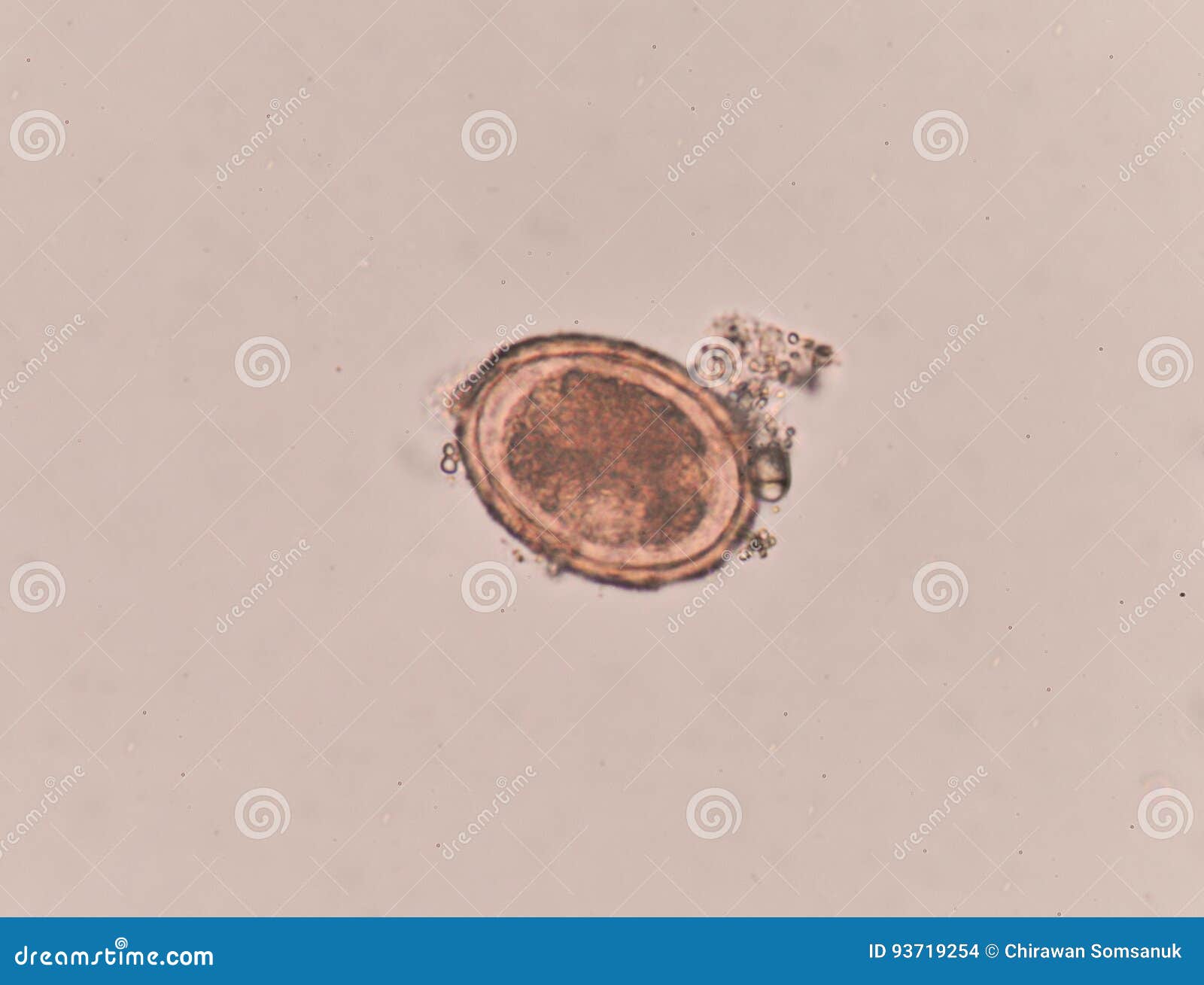 Ascaris Lumbricoides Egg in Stool Exam. Stock Photo Image of