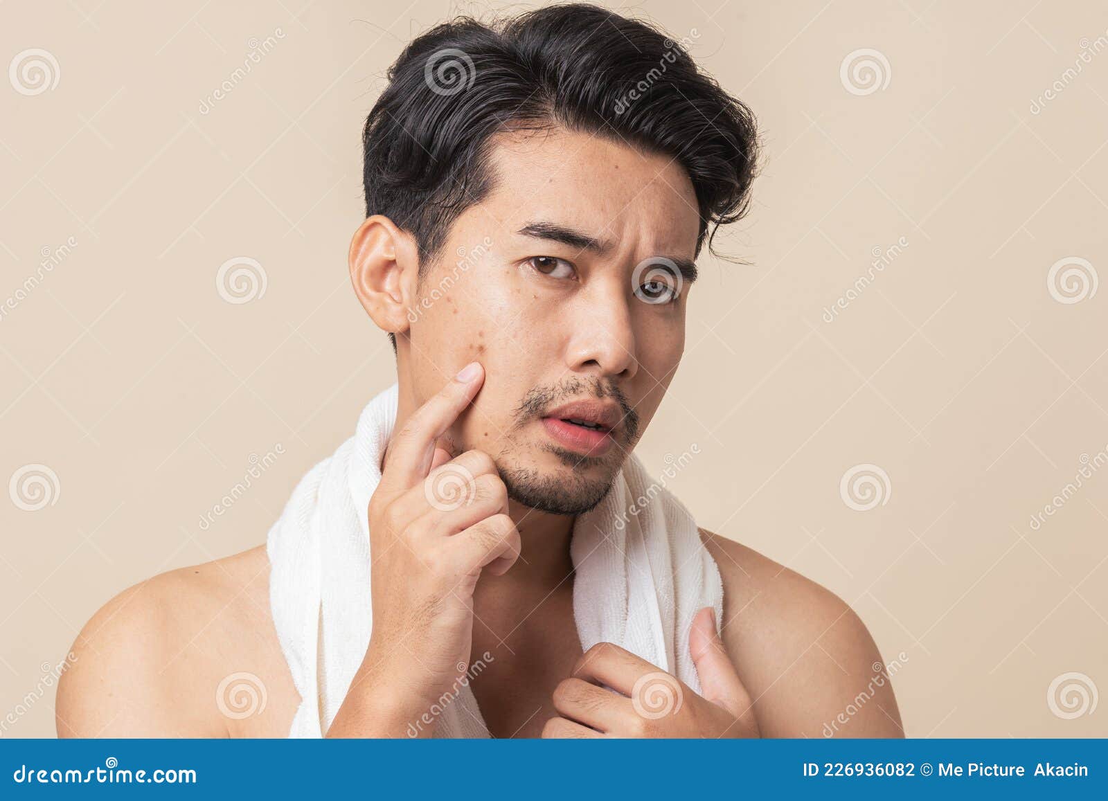 asian man worry have blemish on face caused by acne