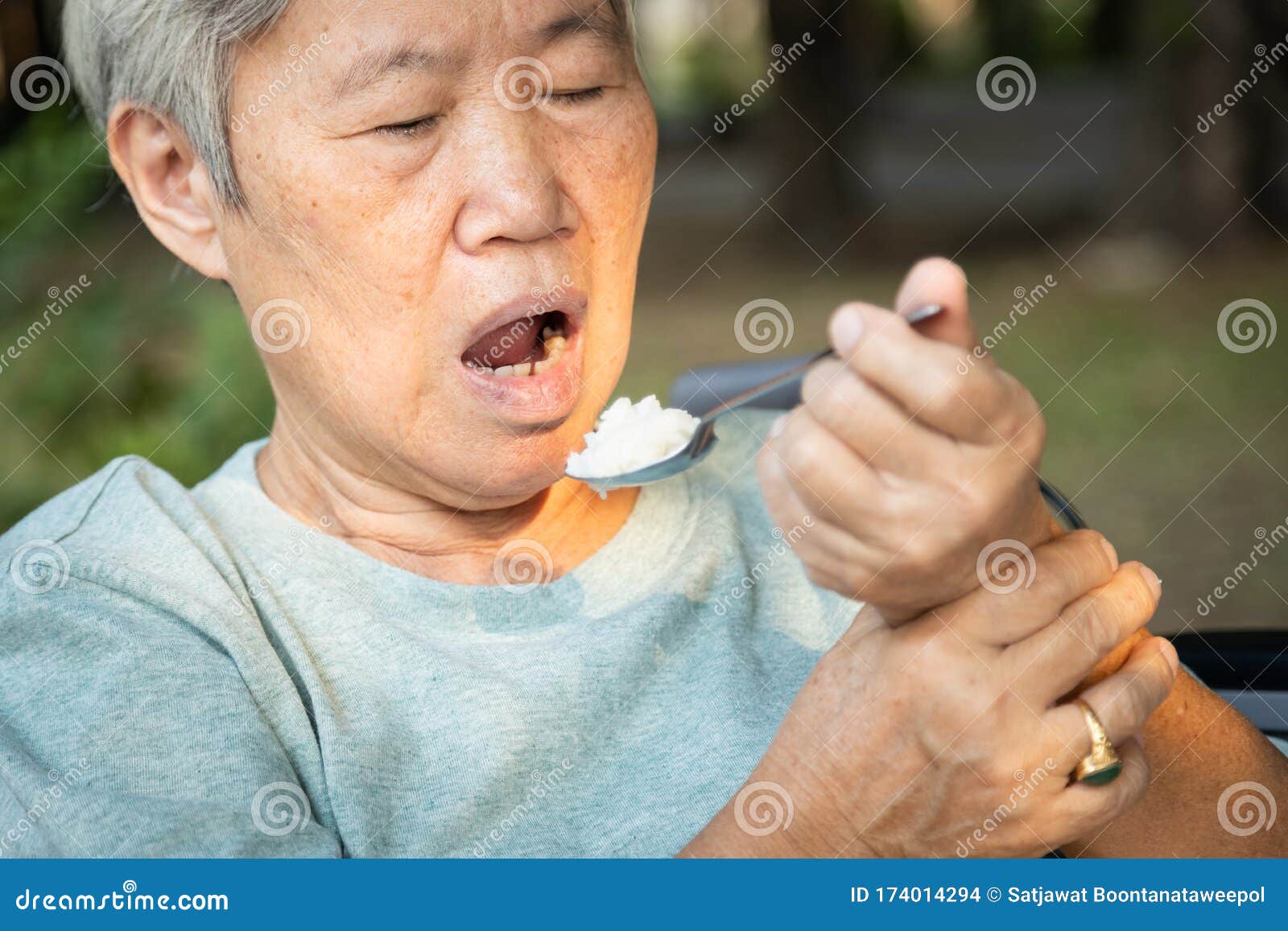 asian senior woman holding spoon and hands tremor while eating rice,cause of hands shaking include parkinson`s disease,stroke,