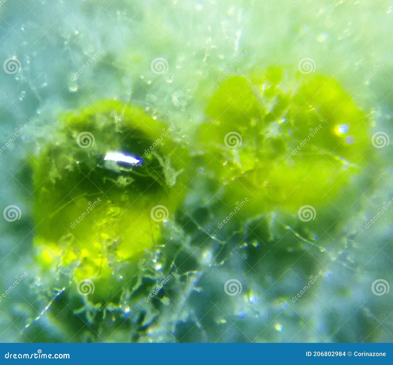 aspergillus flavus mold conidia under the microscope