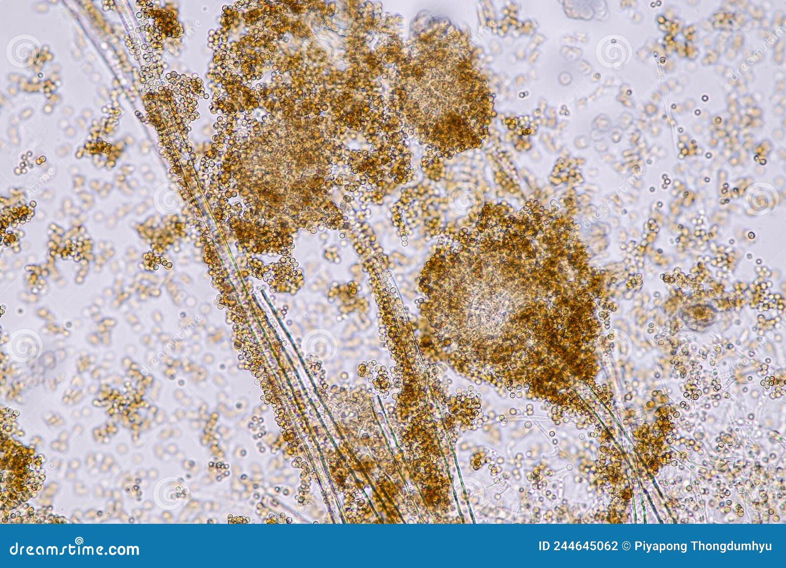 Aspergillus Niger and Aspergillus Oryzae Mold Under Microscope. Stock ...