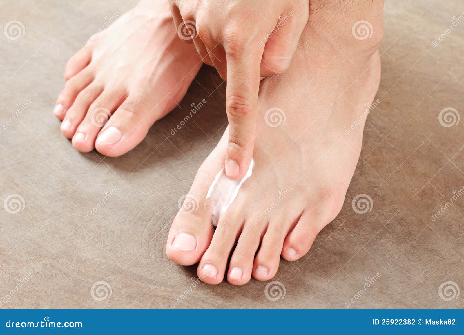 athlete's foot treatment