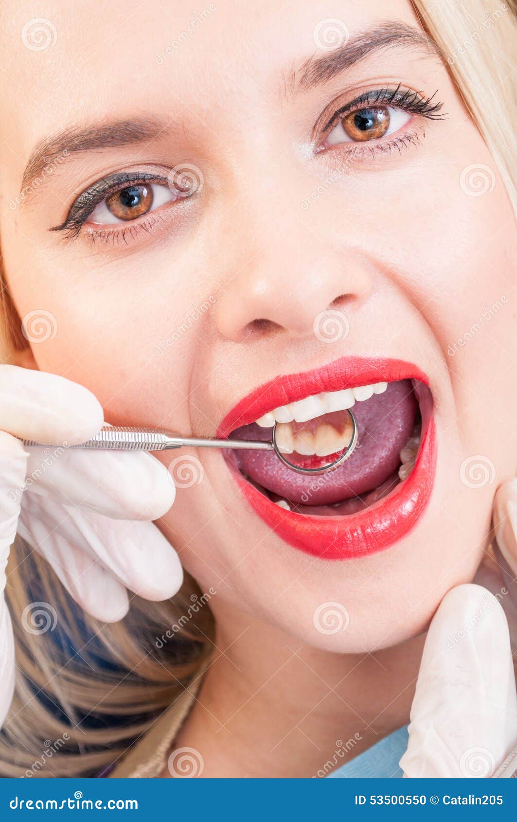Attractive Woman with Beautiful Teeth Stock Photo Image of dentist