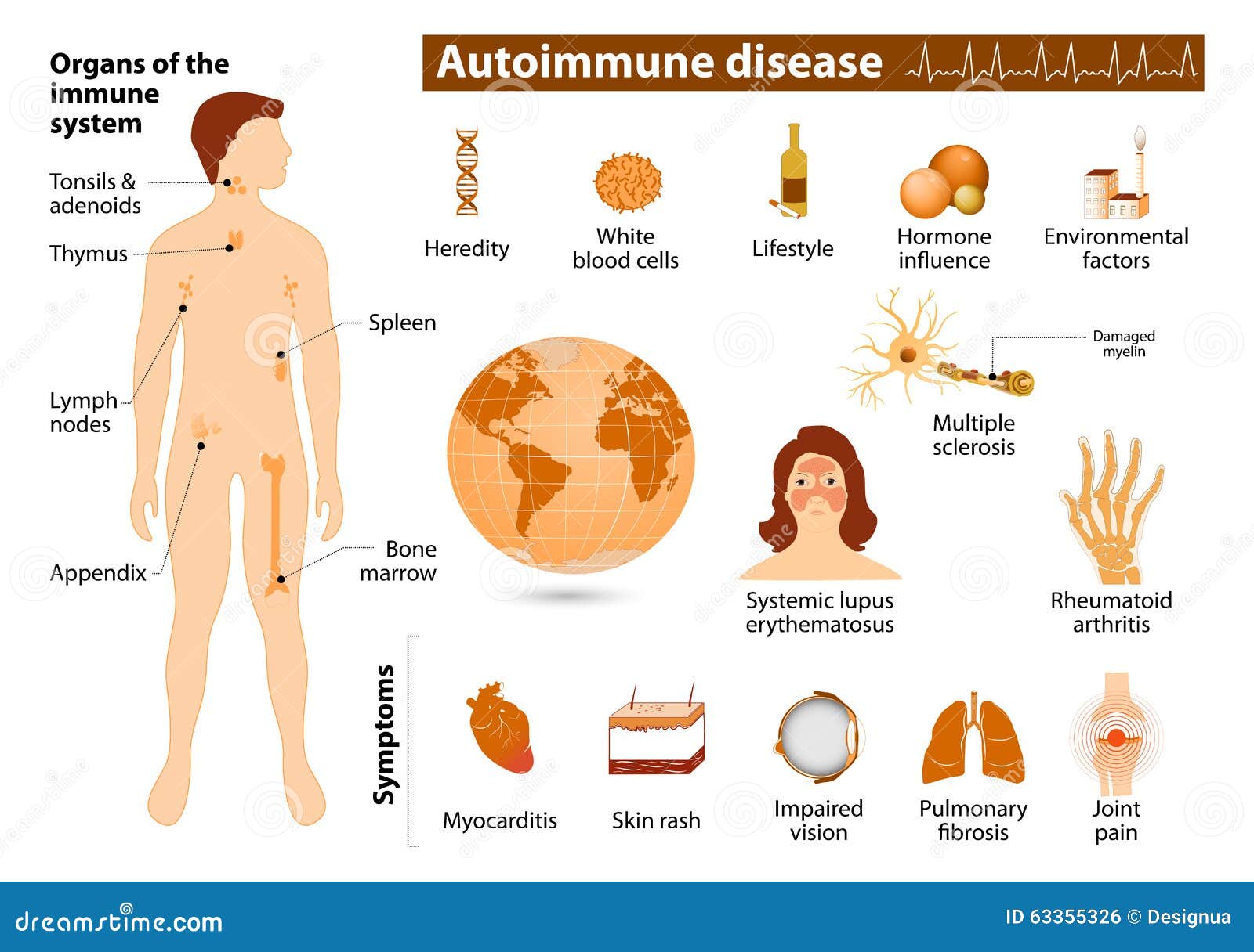 autoimmune disease infographic