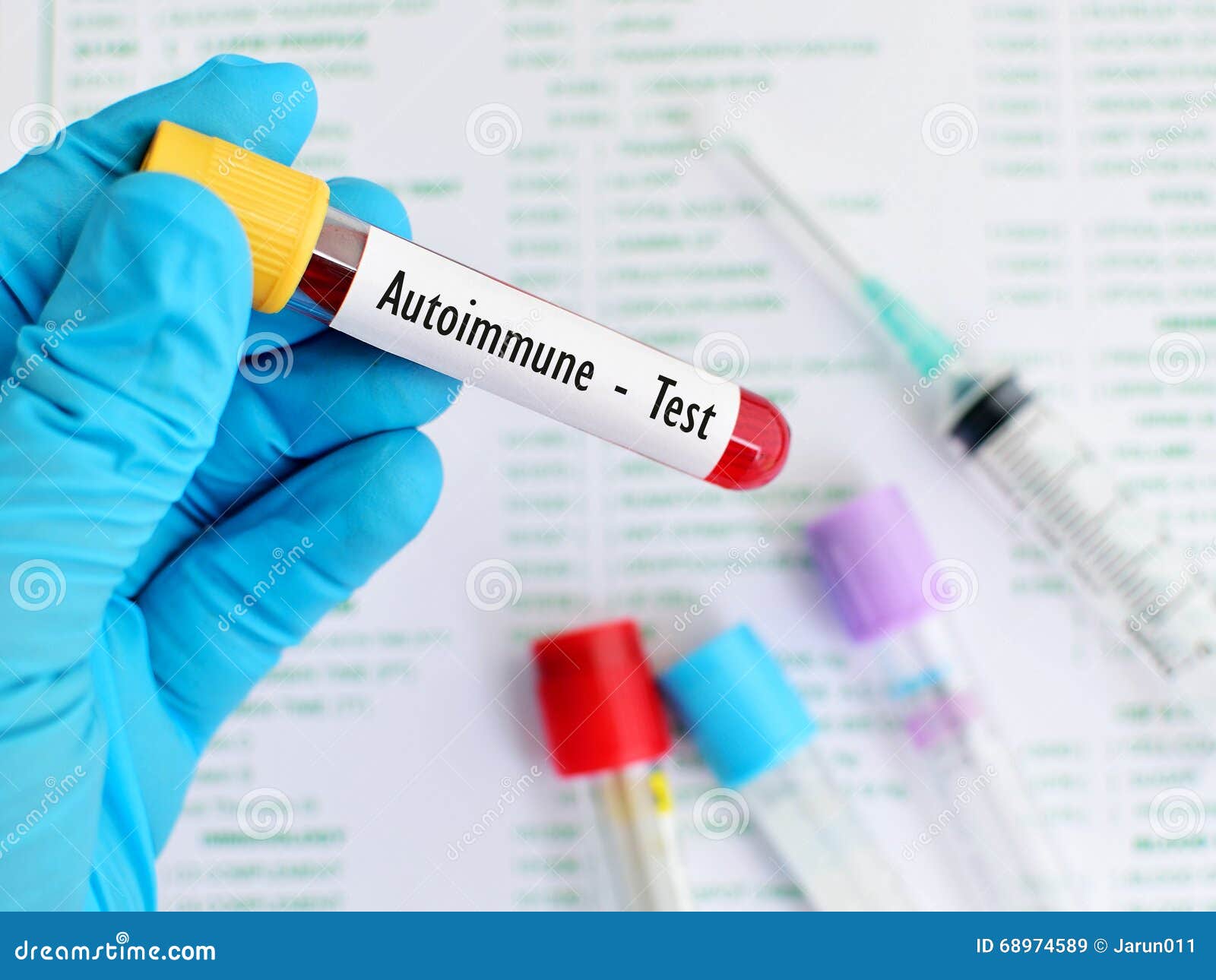 blood test for autoimmune disease