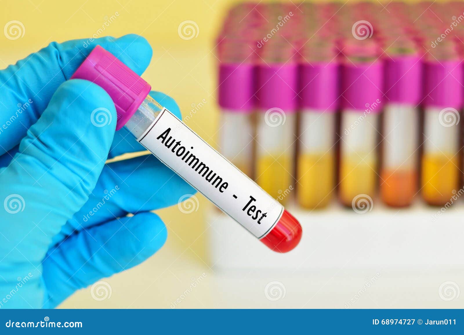 Autoimmune test stock image. Image of disease, scientific 68974727