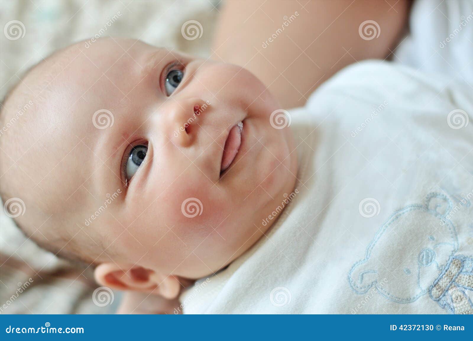 Bebe Avec La Joue Rouge Photo Stock Image Du Pustules Bebe Avec La Joue Rouge Photo Stock Image Du Pustules