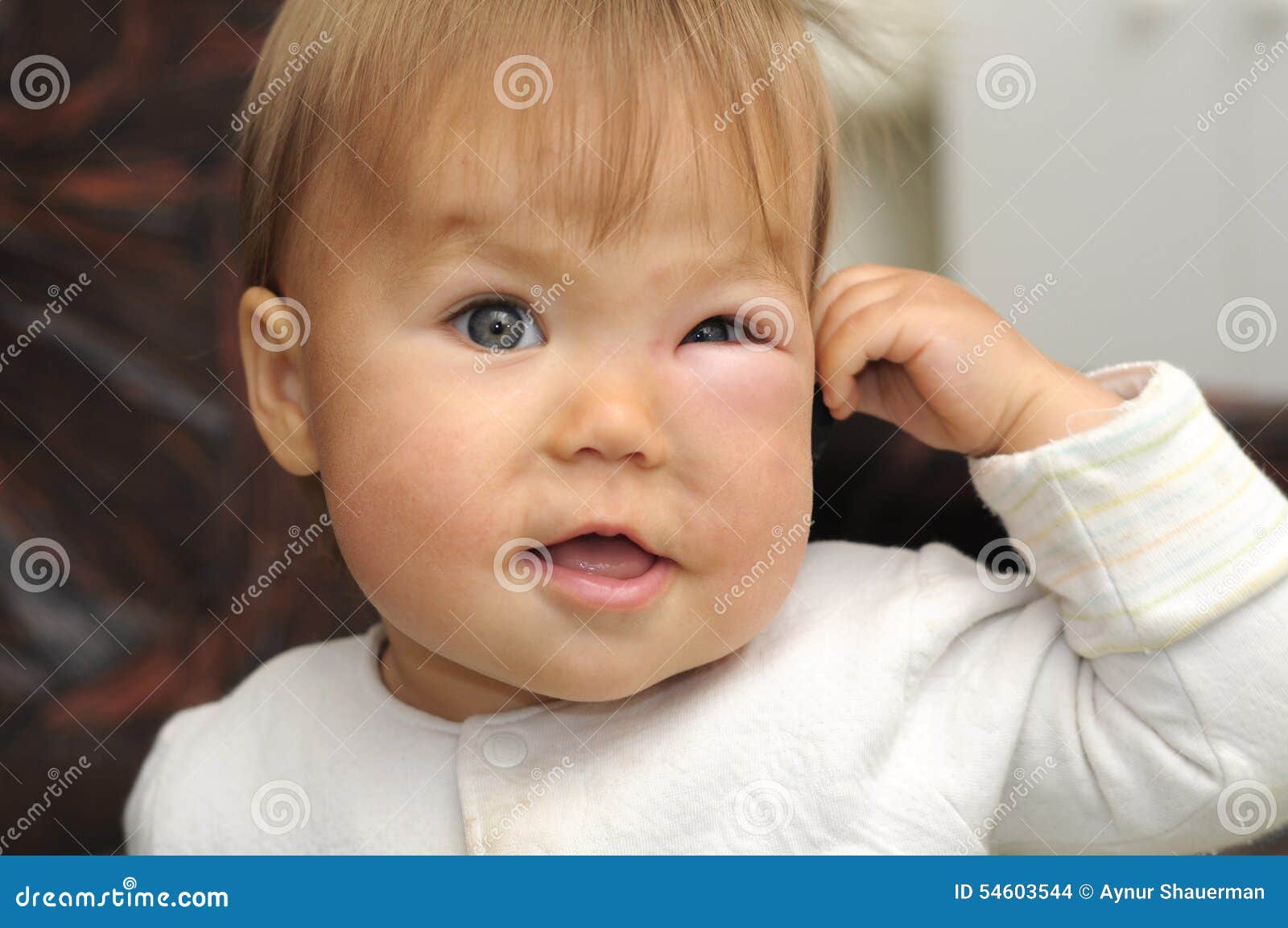 Bebe Avec Un Oeil Gonfle D Une Piqure D Insectes Photo Stock Image Du Houle Insecte Bebe Avec Un Oeil Gonfle D Une Piqure D Insectes Photo Stock Image Du Houle Insecte