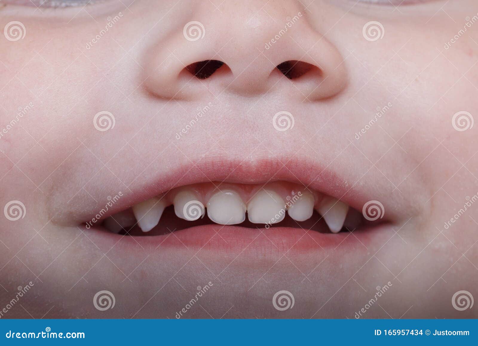 Bebe Dent Gros Plan De La Dent Qui Tombe Une Macro Prise Photo Stock Image Du Jeune Bouche