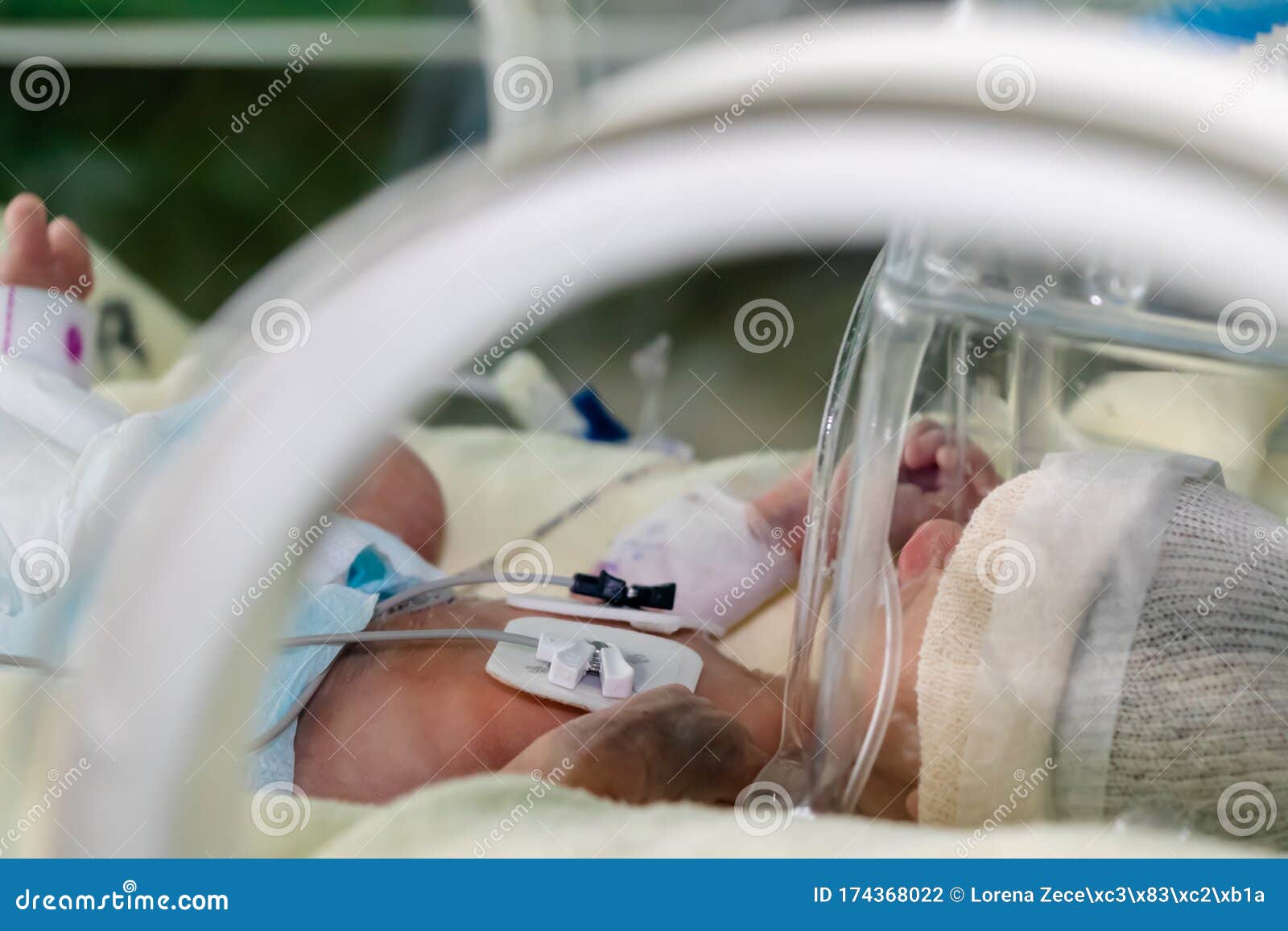 Bebe Malade Nouveau Ne Dans Une Couveuse Photo Stock Image Du Pepiniere Hopital Bebe Malade Nouveau Ne Dans Une Couveuse Photo Stock Image Du Pepiniere Hopital