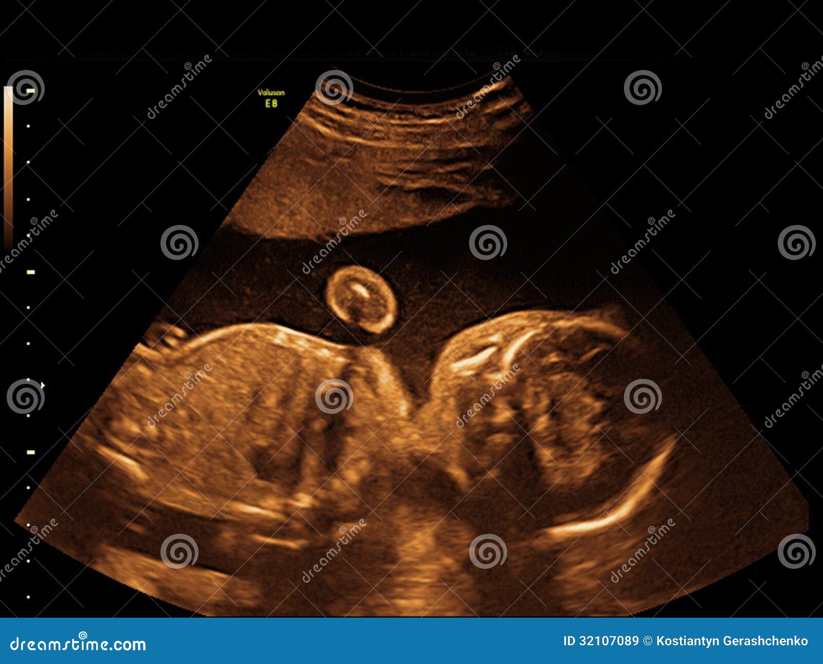 Ein Baby auf dem Ultraschallbild