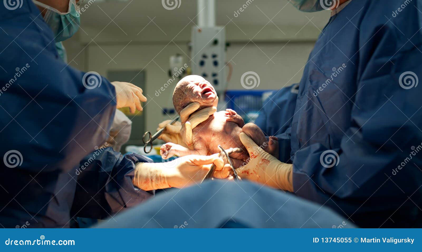 Baby Being Born Via Caesarean Section Stock Image - Image ...