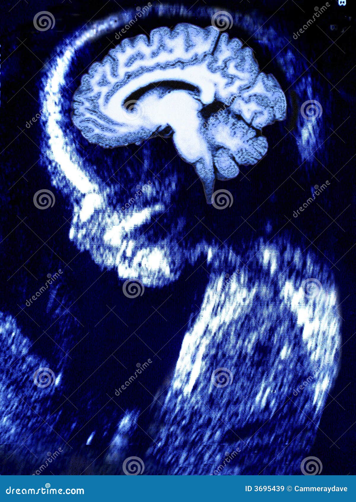 baby brain ultrasound ct scan