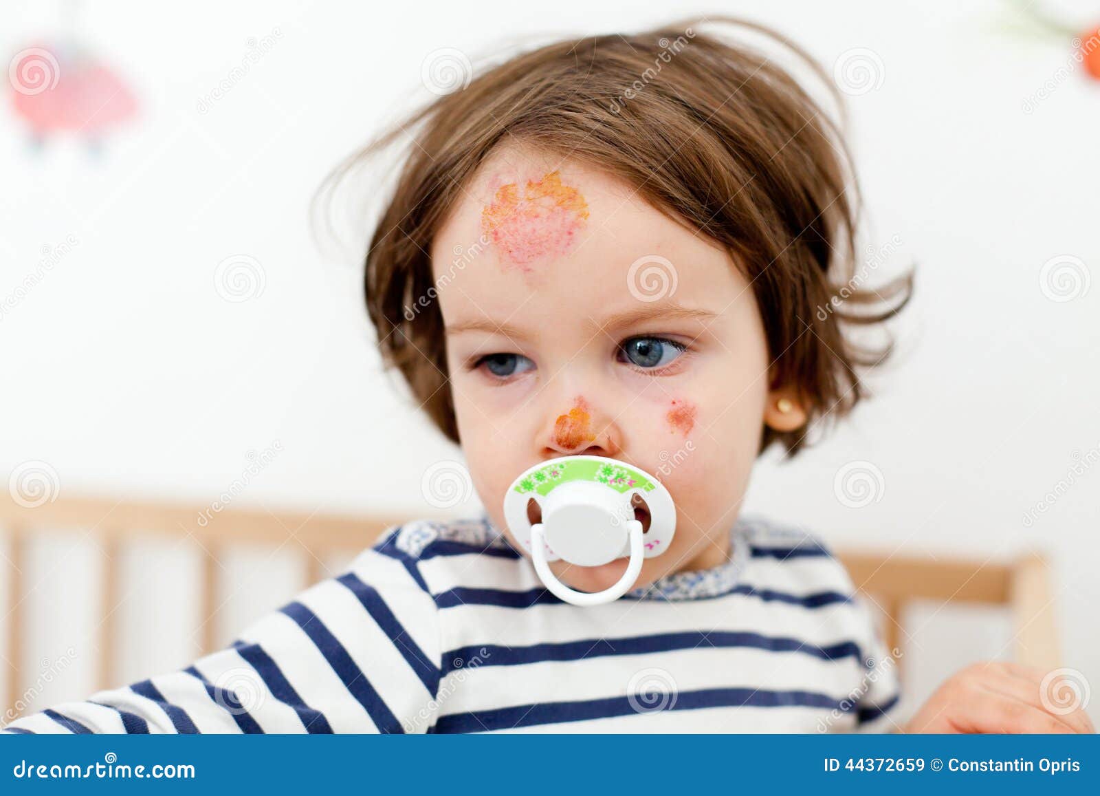 Face bruises and scratches stock image. Image of heartbreaking 44372659