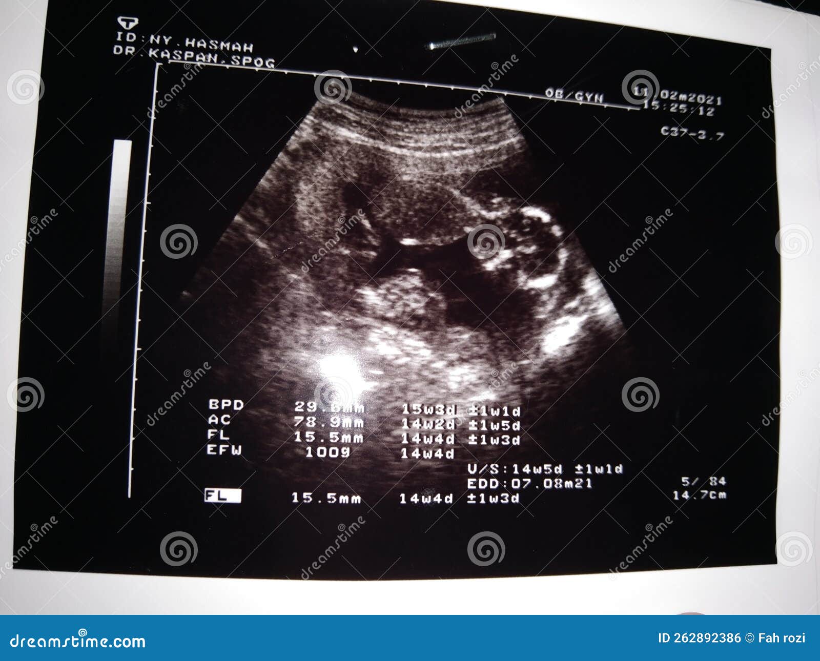 The baby USG stock photo. Image of baby, grenpa, hasben 262892386