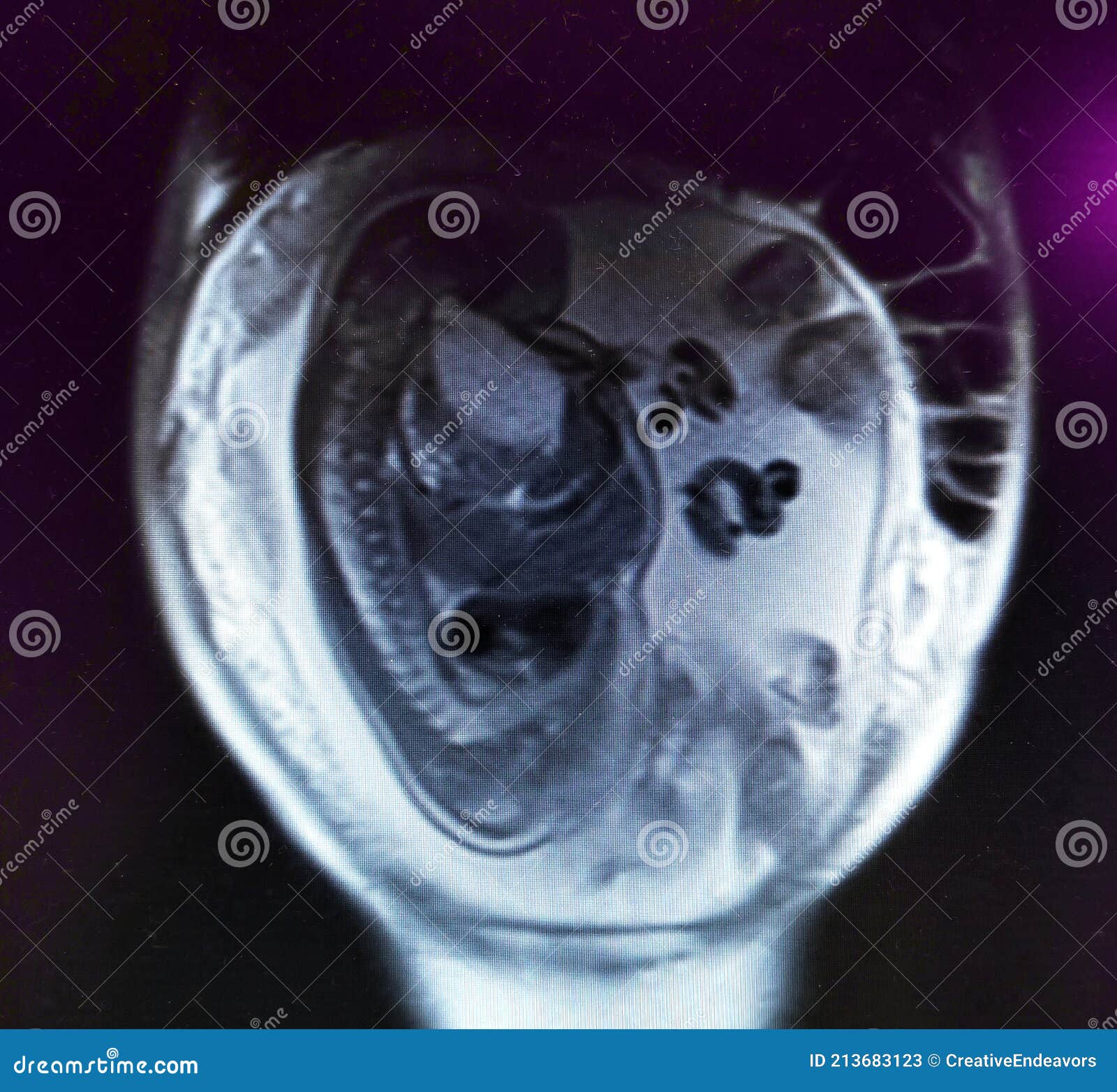 All 98+ Images mri of a baby in the womb Sharp