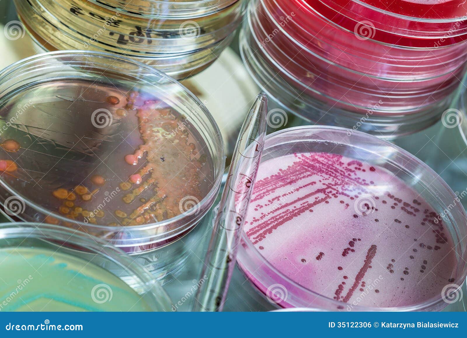 Laboratory tests for bacterial infections