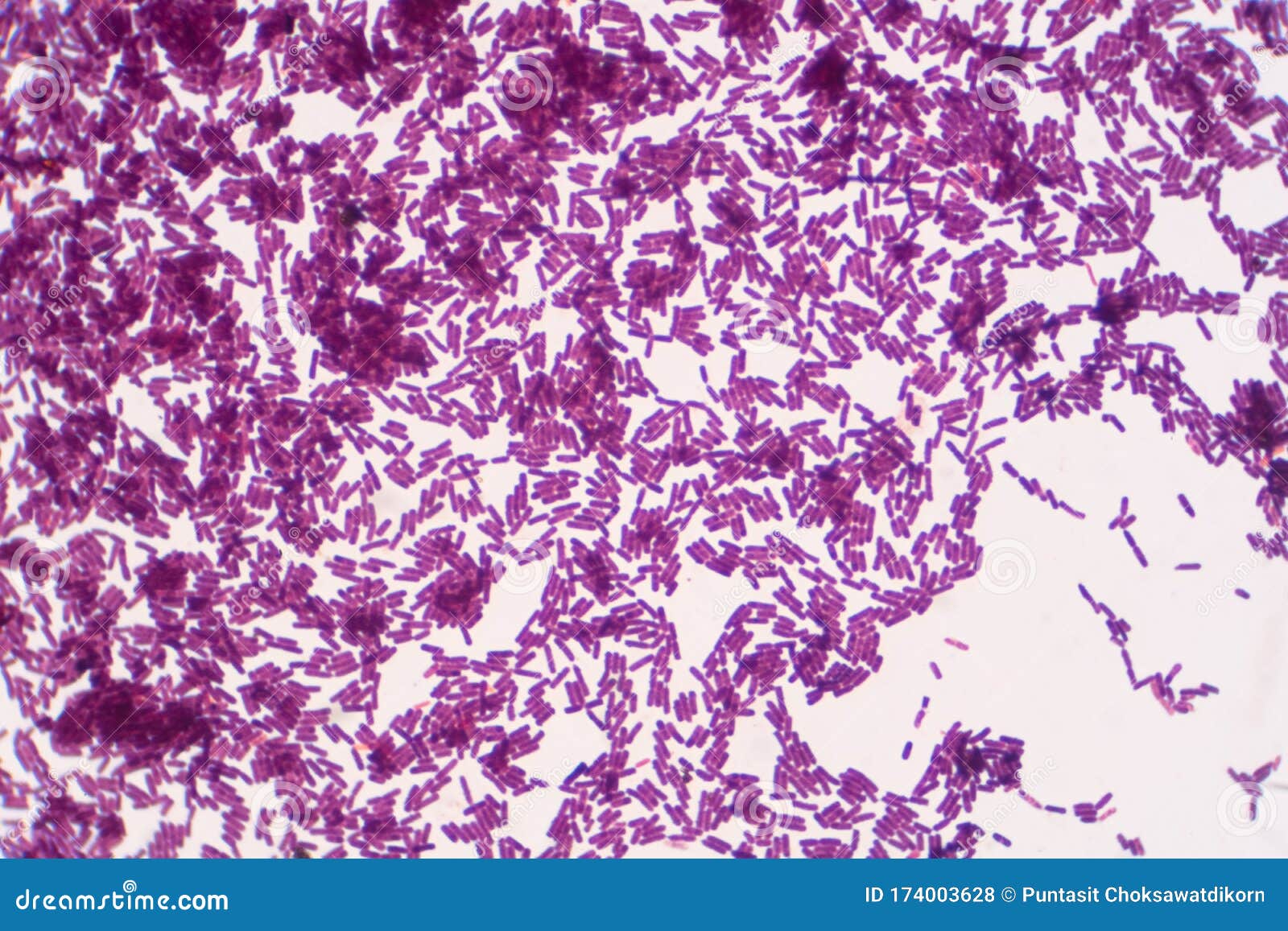bacillus gram positive stain under microscope view. bacillus is rod-d bacteria