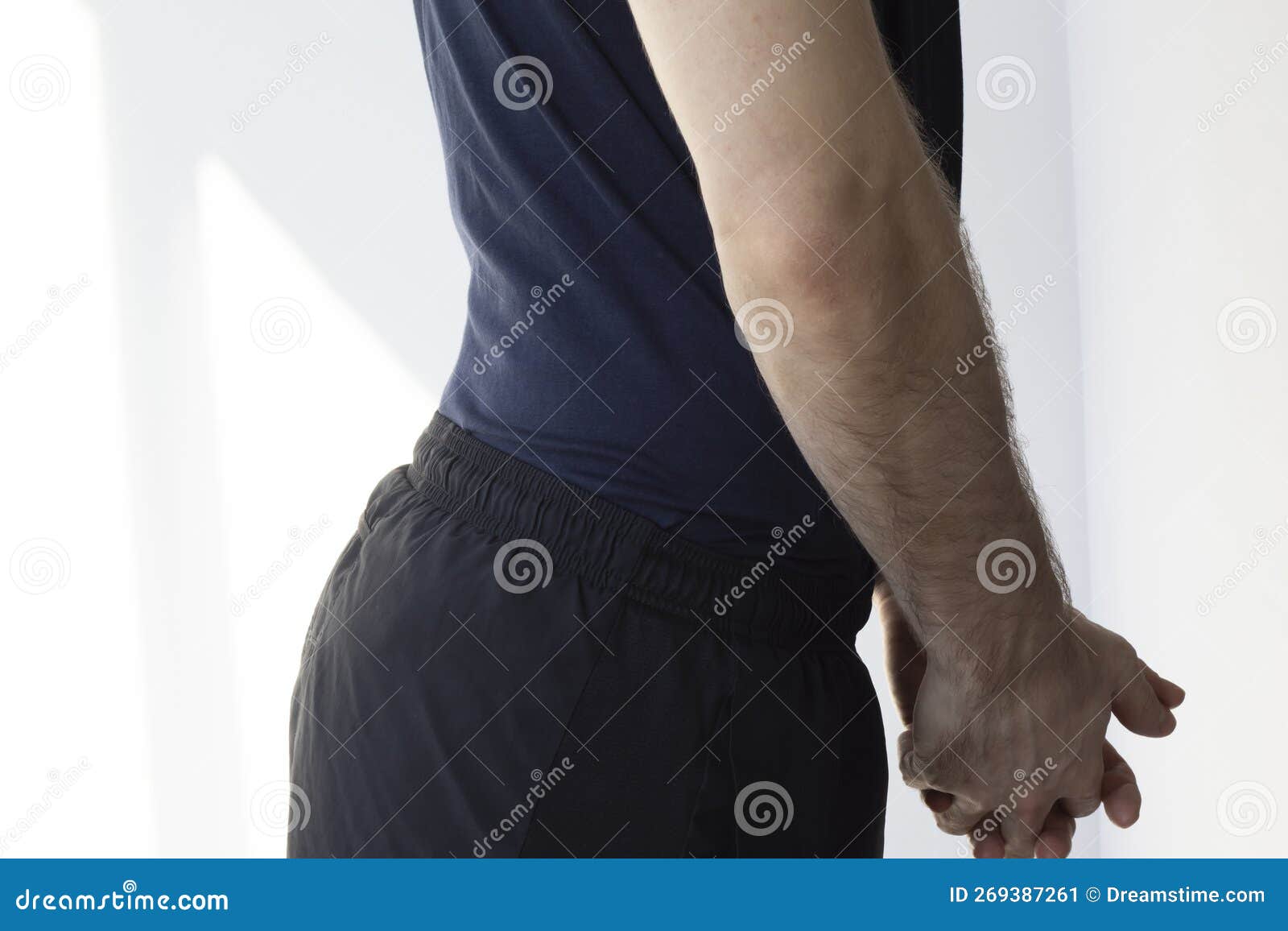 Back Curvature in Men in the Lumbar Spine Hyperlordosis Stock Image