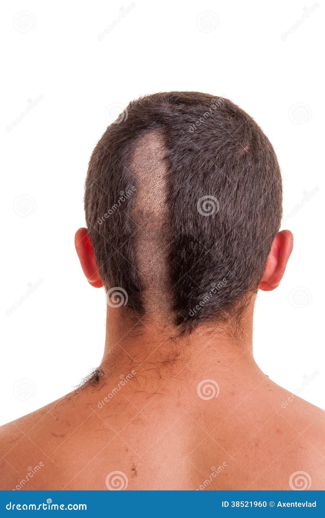 back of man head while his hair is cut stock photo - image