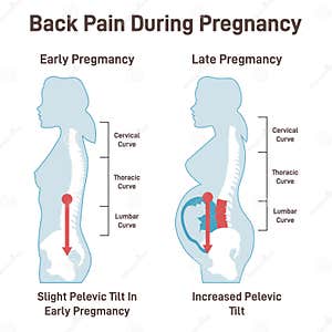 Back Pain During Pregnancy Pregnant Woman Experiencing Extreme Stock 