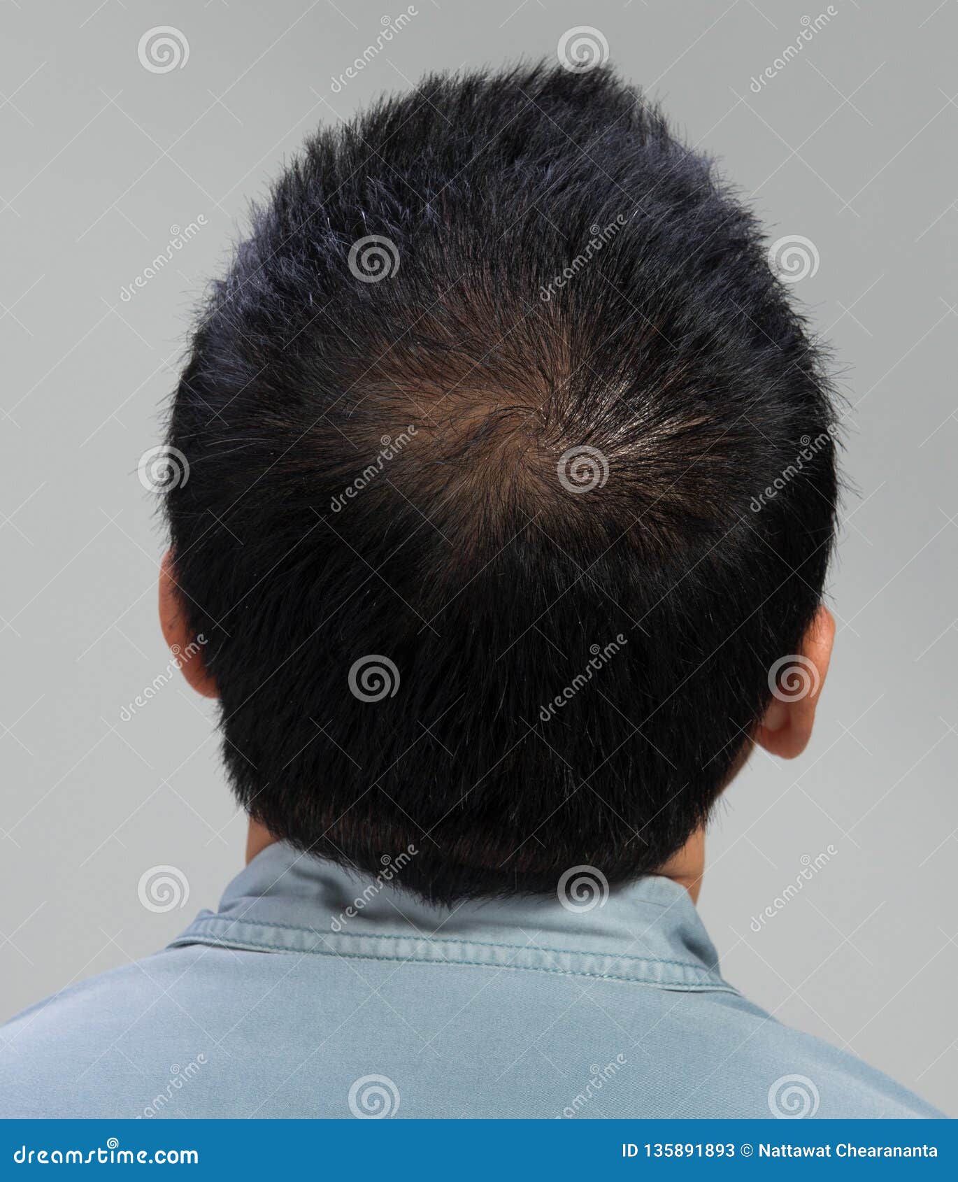 Back View of Male Hair Head Part Bald Stock Image - Image of fall, head:  135891893