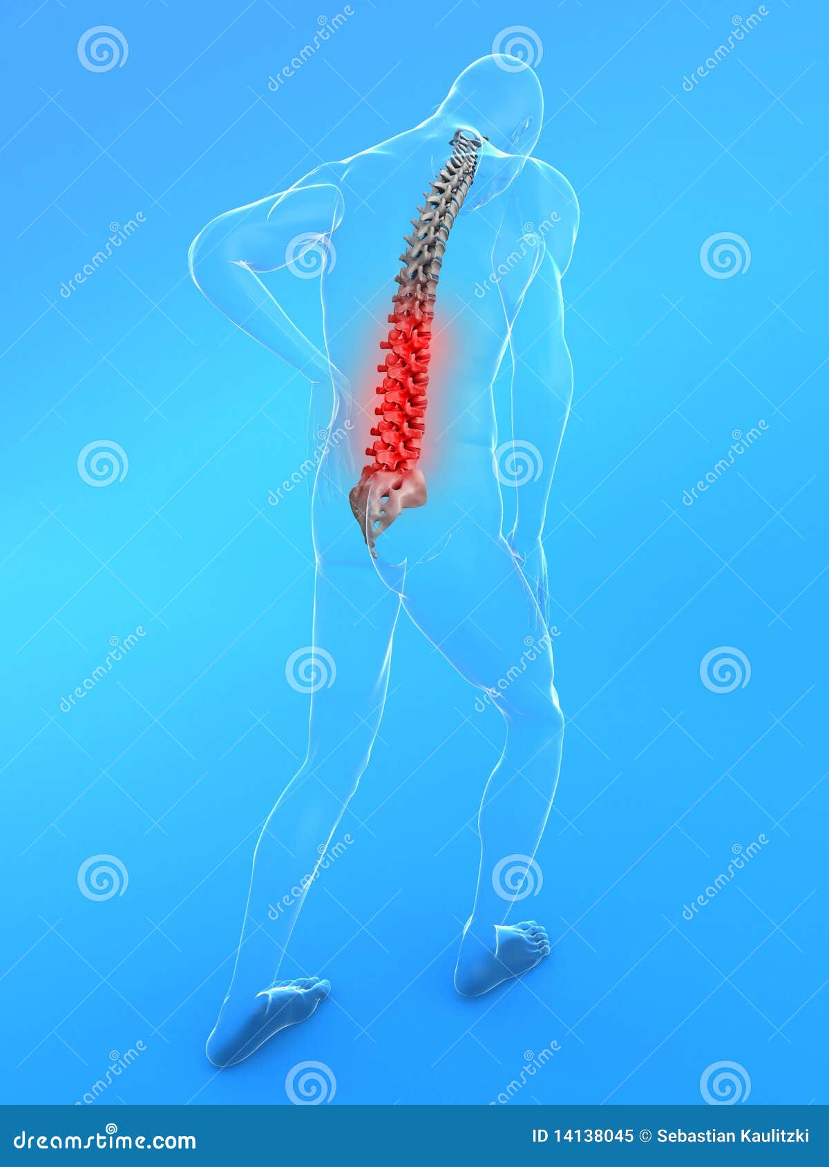 Backache stock illustration. Illustration of torso, osteoporosis 14138045
