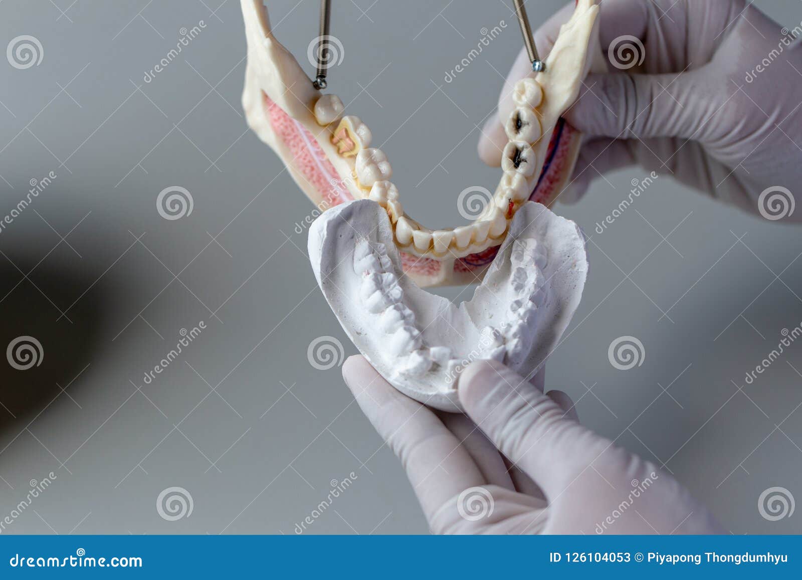 Tooth Model for Education in Laboratory. Stock Image Image of dentist