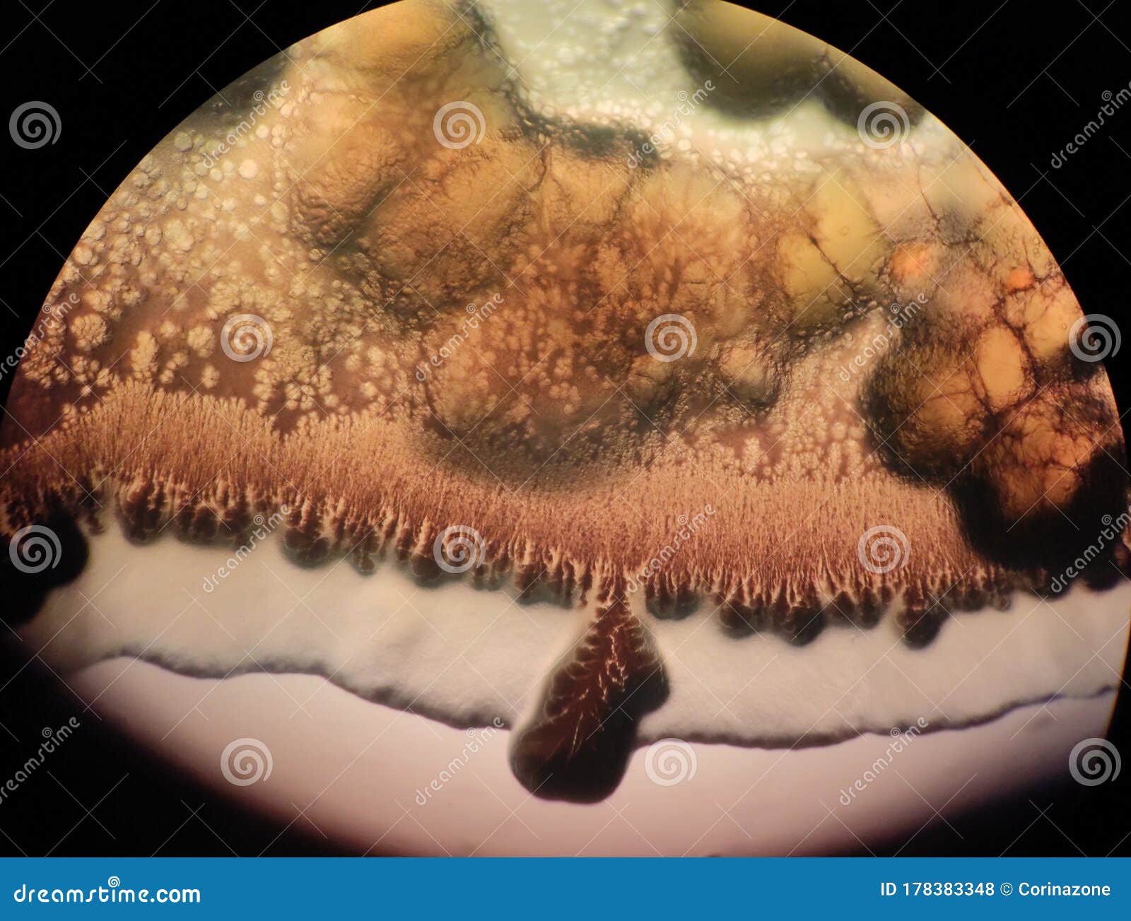 When the Bacteria is the Artist Beuatiful Growth Under the Microscope