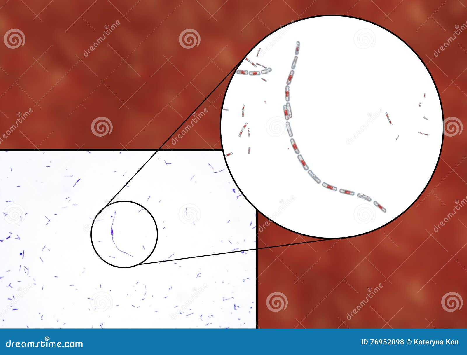 bacteria bacillus anthracis