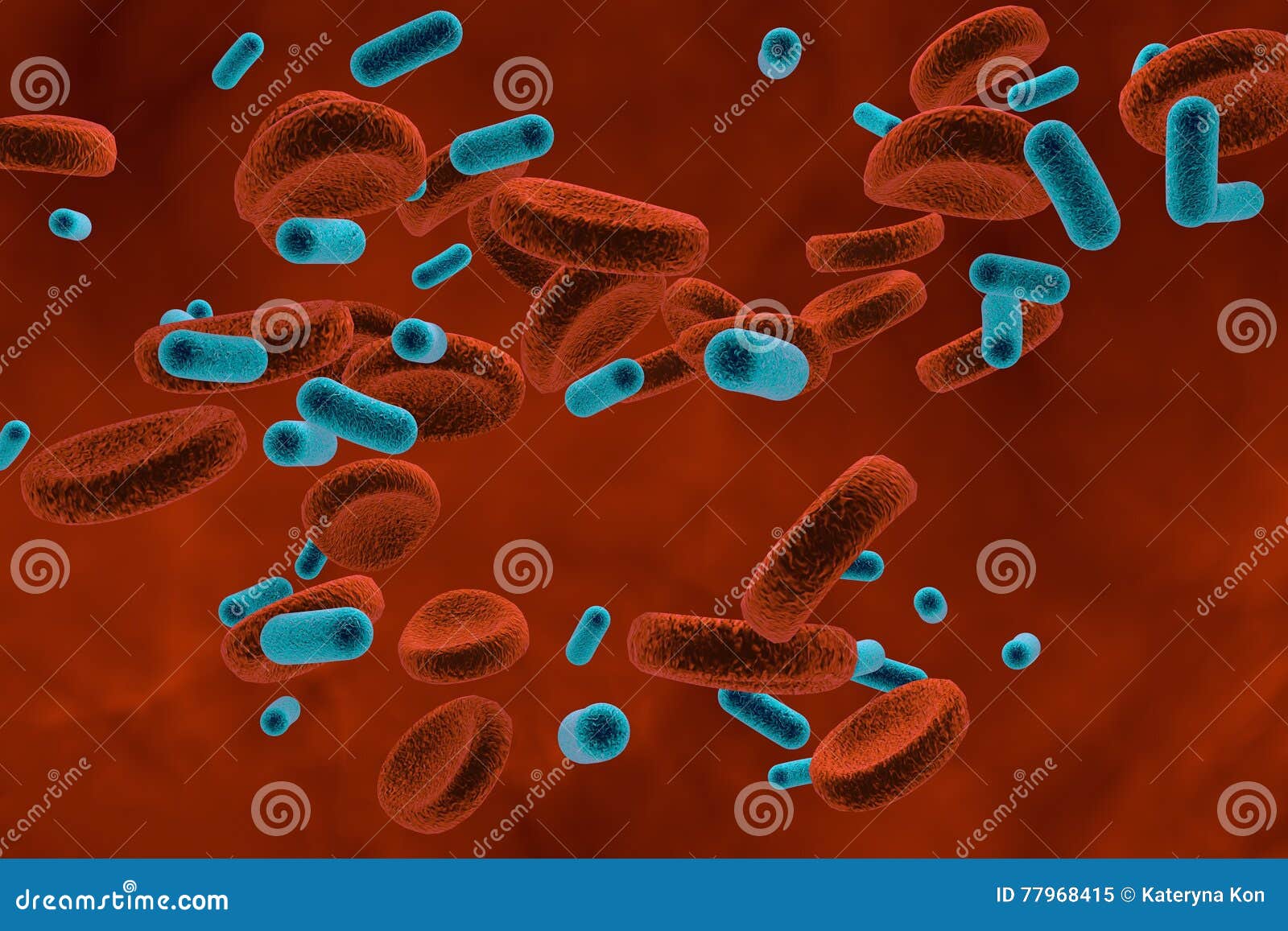 Bacteria in Blood, Bacteriemia Stock Illustration Illustration of disease, klebsiella 77968415