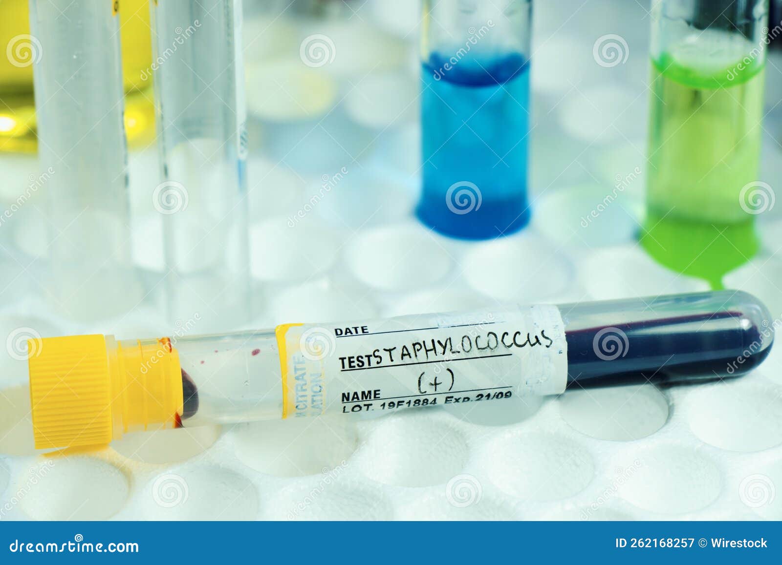 Bacteria, Blood Test Tube Samples Stock Image Image of medical, text