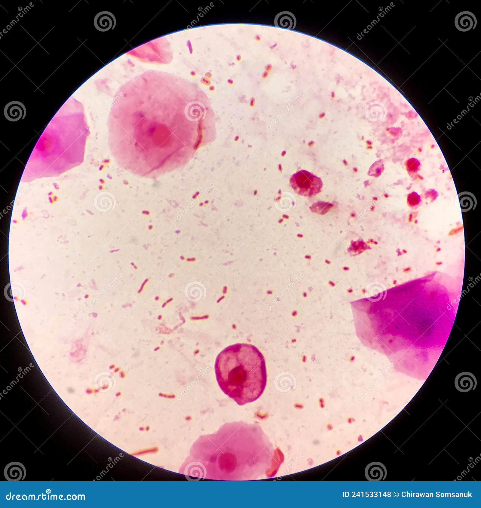 Bacillus Gram Positive Stain Under Microscope View. Bacillus Is Rod