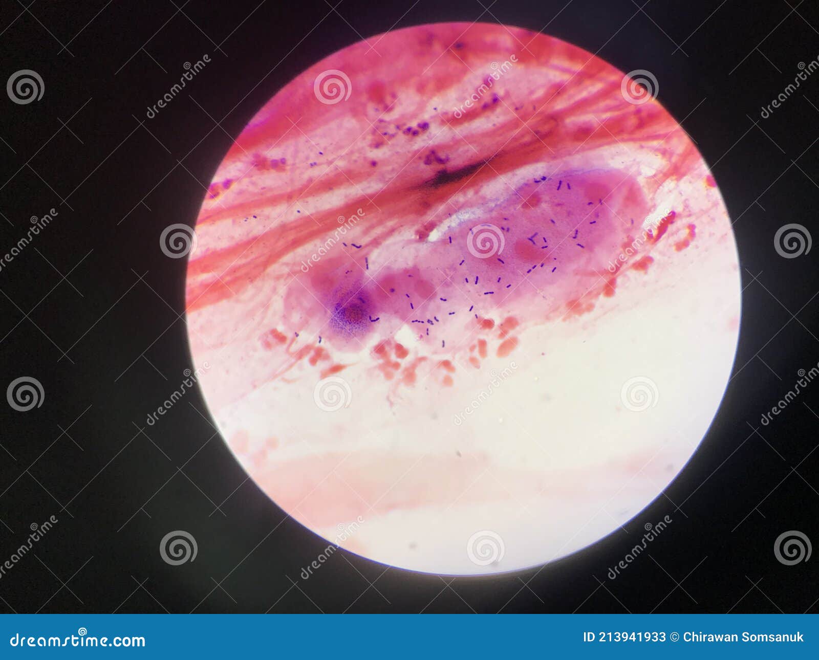 Bacillus Gram Positive Stain Under Microscope View. Bacillus Is Rod