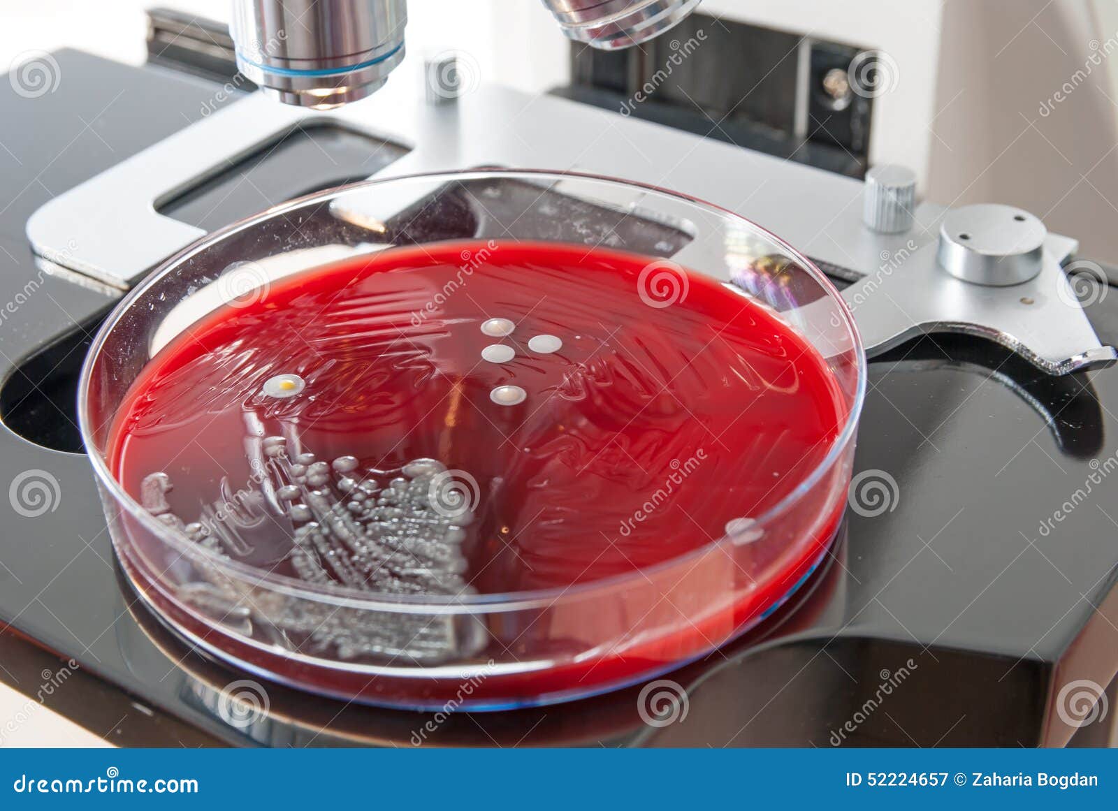 Bacteria Colonies on Petri Dish Under the Light of the Microscope Stock