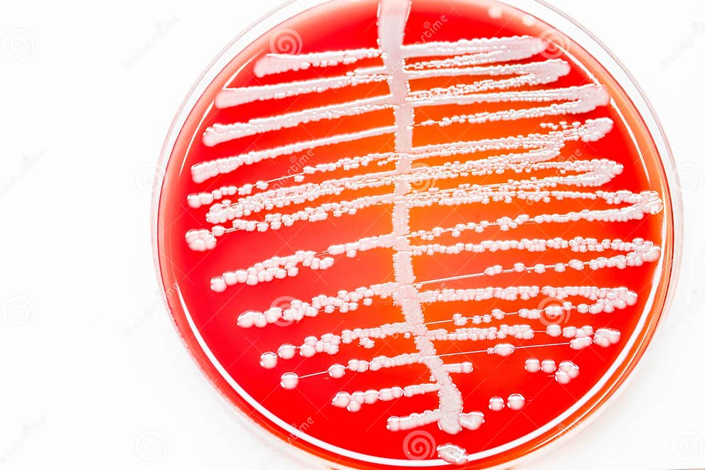 bacteria-in-urine-under-microscope-urinary-tract-infection-youtube