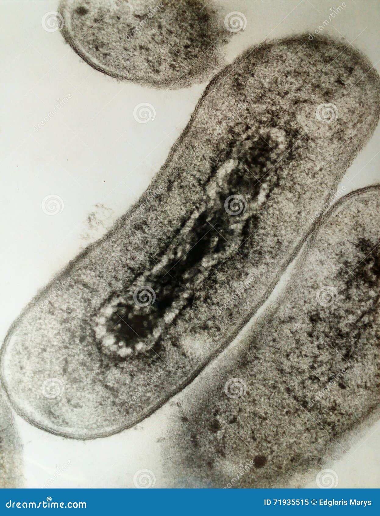 Electron Microscopy of Bacteria Stock Image Image of illness