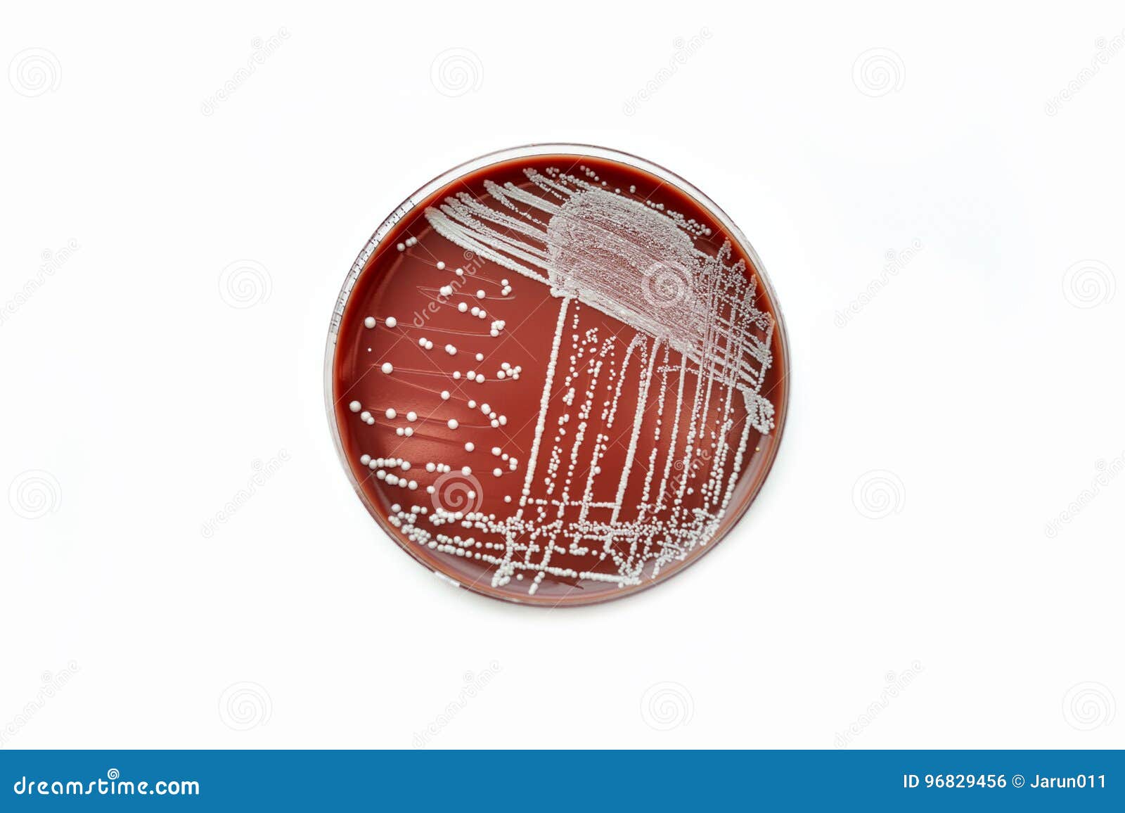 Chocolate Agar(CA) Are Selective Media For Bacteria Growth. Stock Image