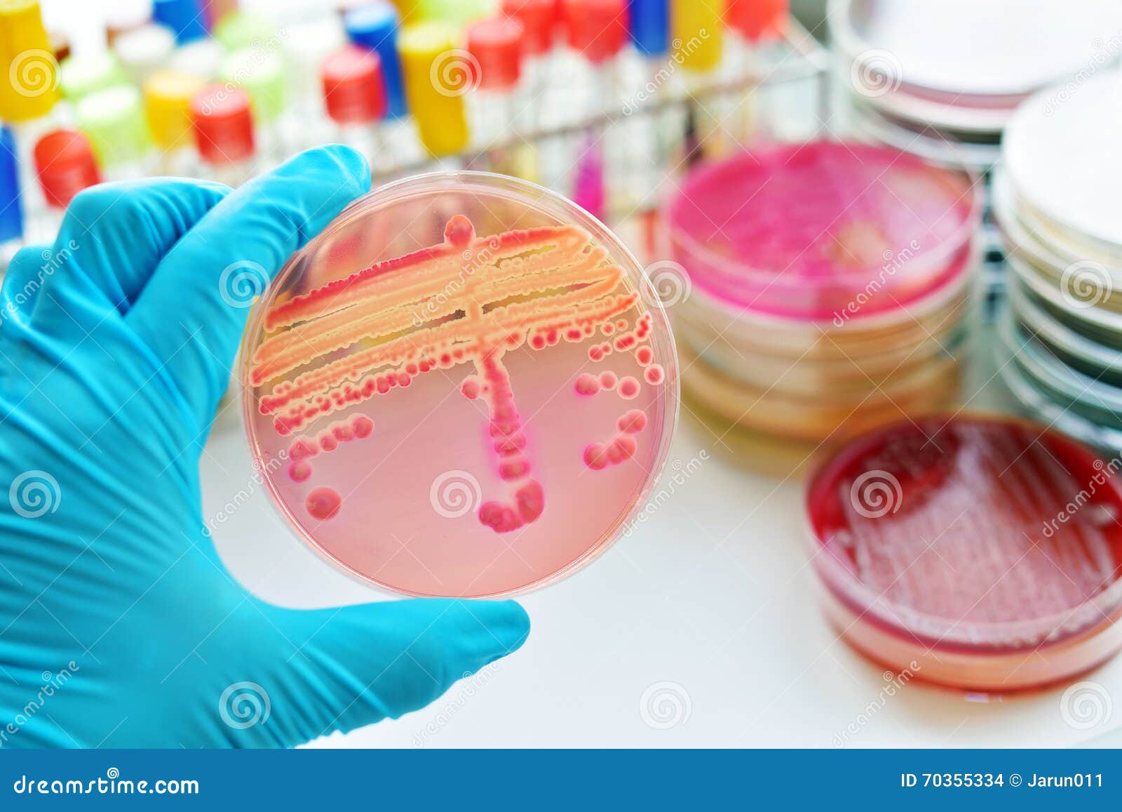 bacteria culture