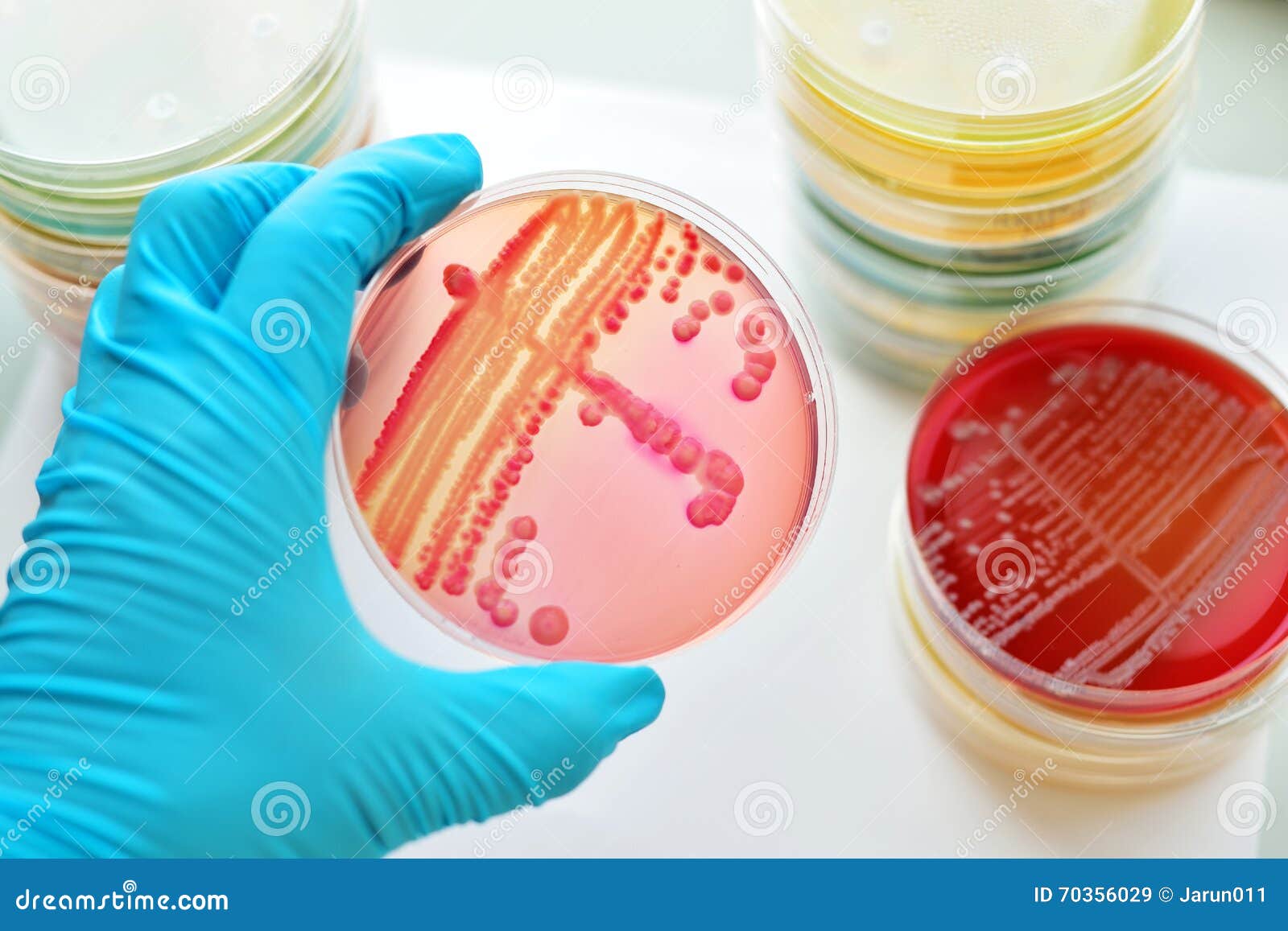 Bacteria culture stock image. Image of culture, 70356029