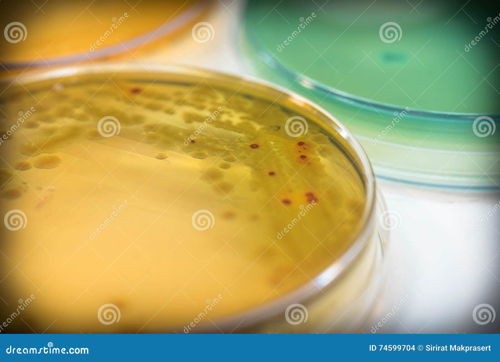 pseudomonas aeruginosa on macconkey agar