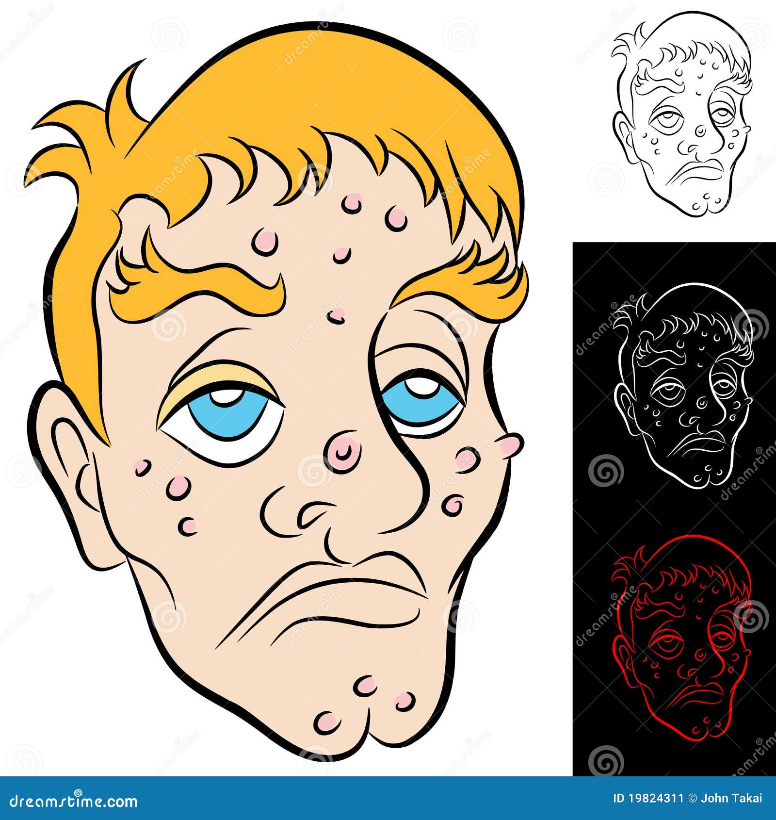 Bad Face Man stock vector. Illustration of pimple, breaking - 19824311