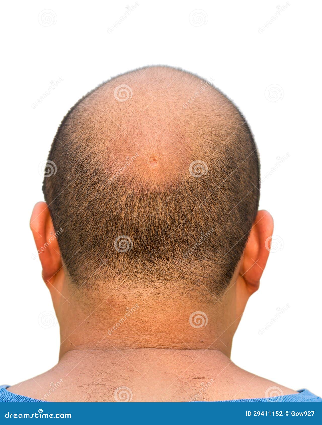 Bald head isolation stock photo. Image of head, crater - 29411152