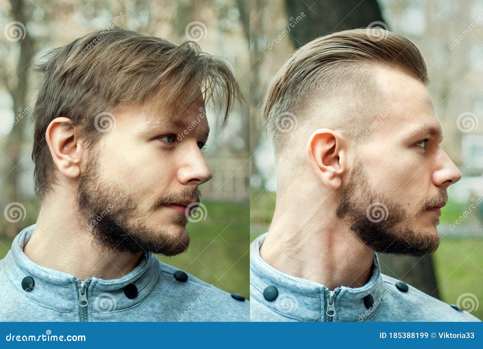 Bald Man before after Haircut Concept for a Barber Shop: the Problem Man of  Hair Loss, Alopecia, Transplantation, Side Stock Image - Image of shirt,  face: 185388199