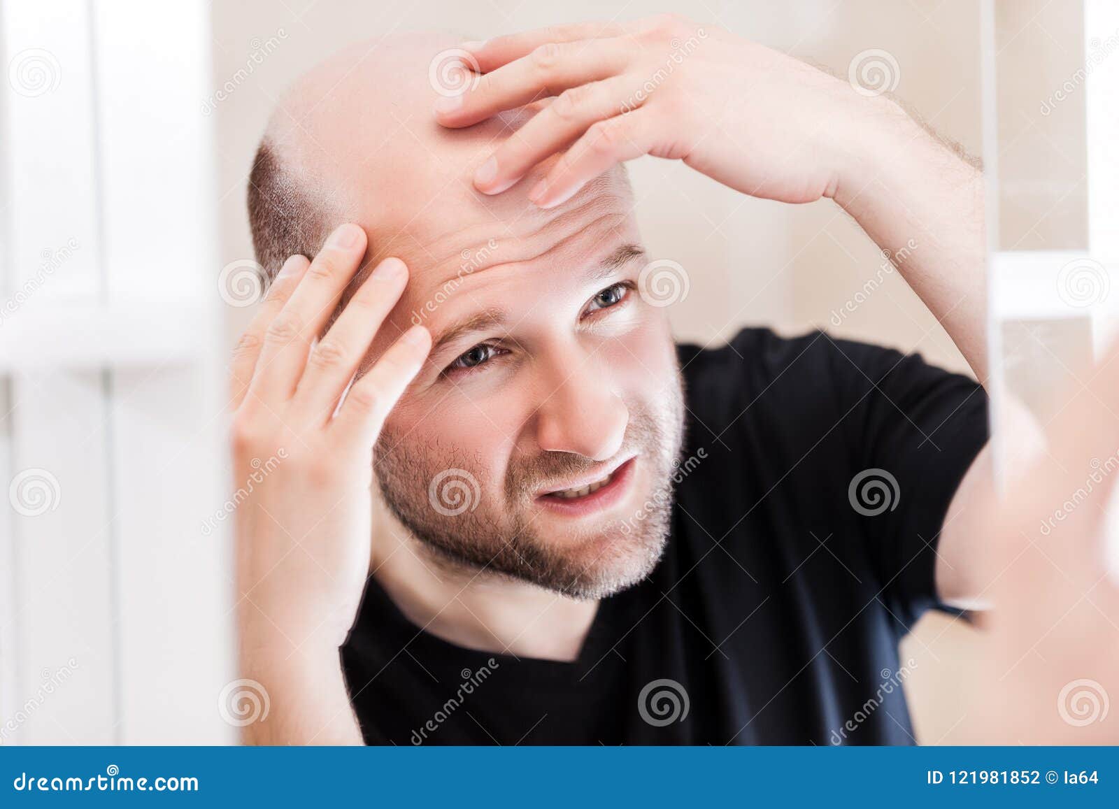 bald man looking mirror at head baldness and hair loss