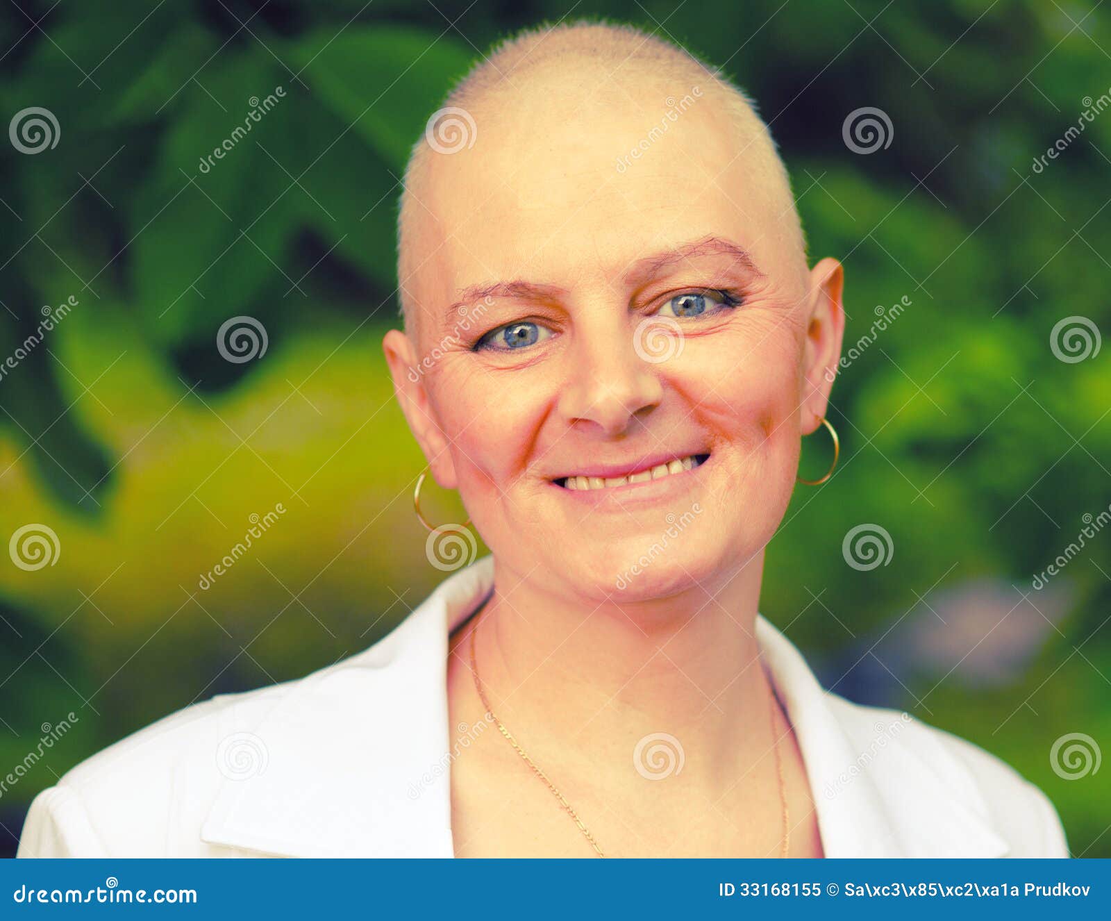 bald woman - cancer survivor