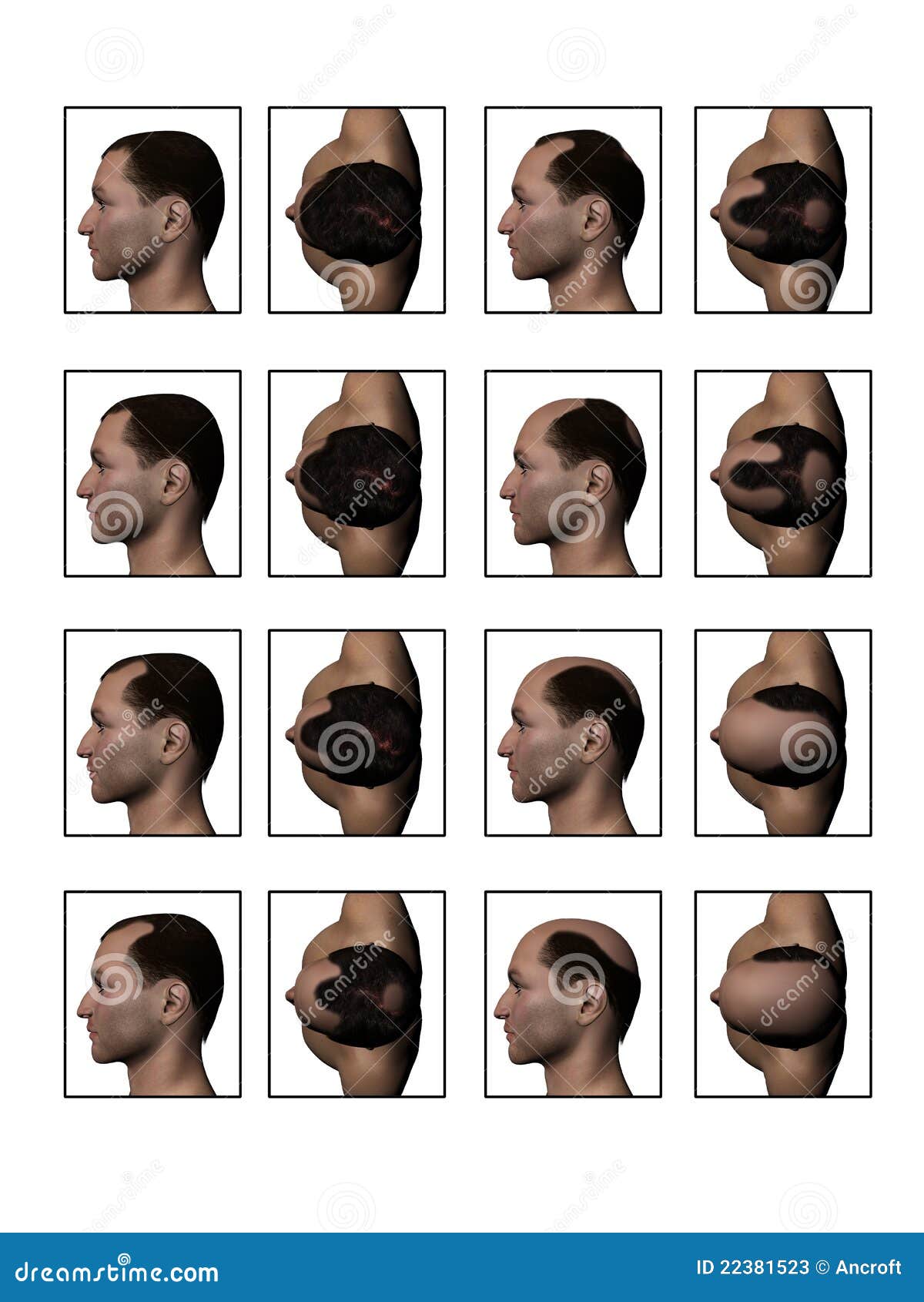 Hairline Chart