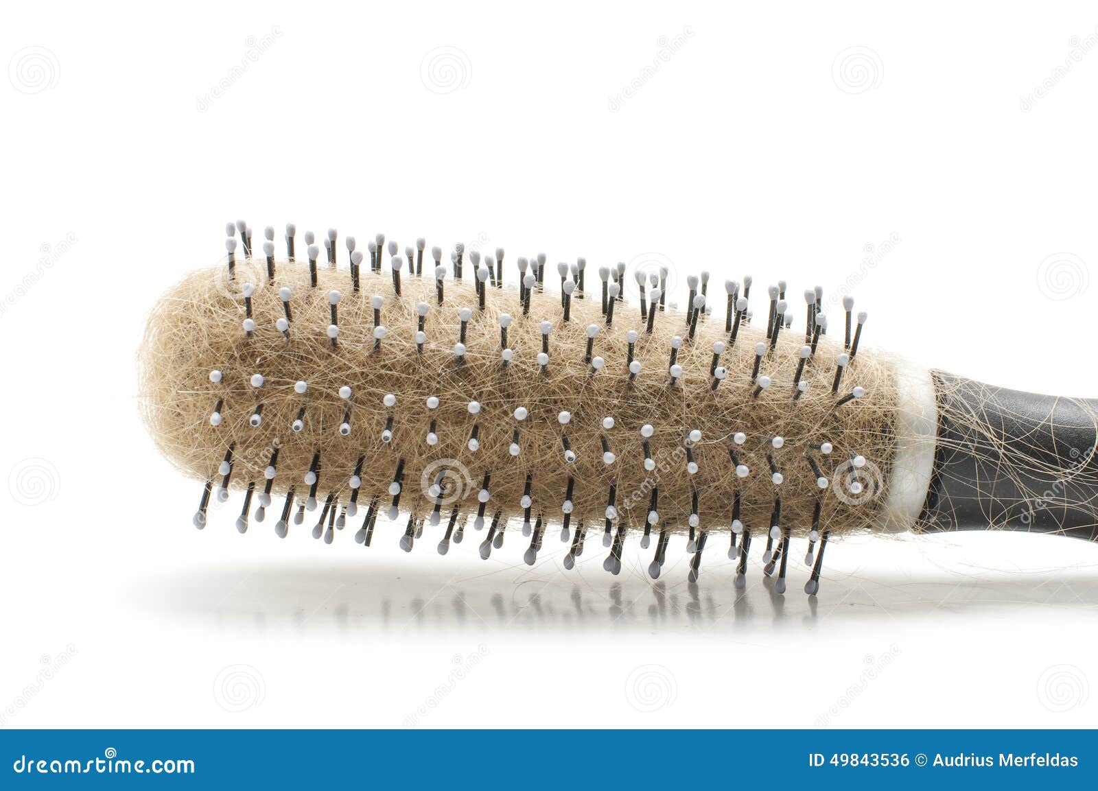 Baldness and Dandruff Problem Stock Photo Image of hairless, health 49843536